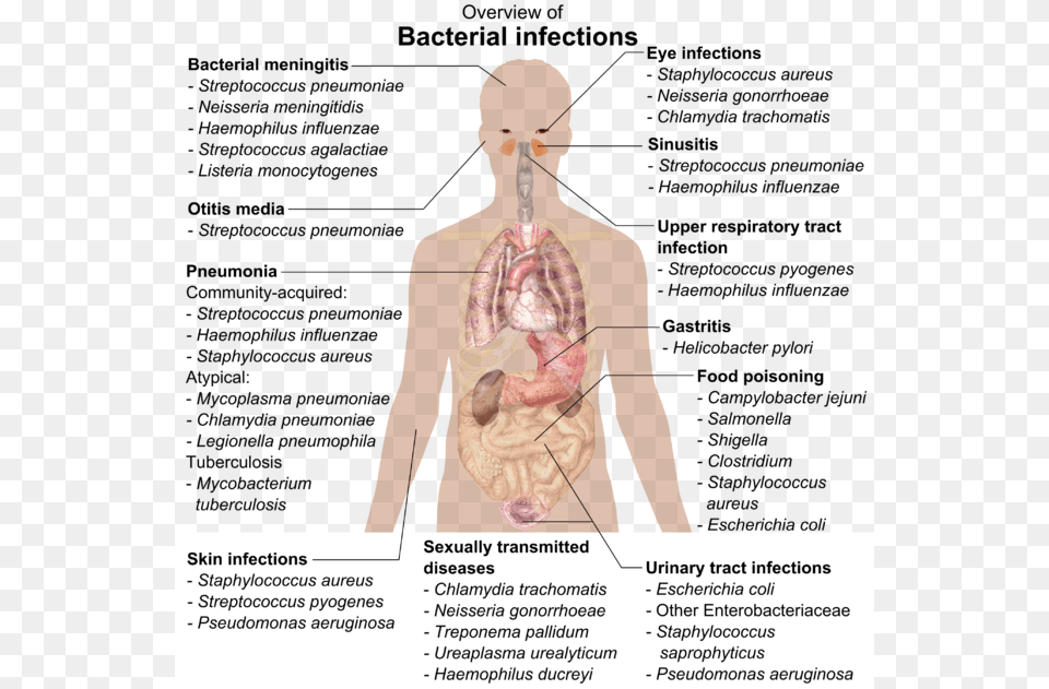 Overview Of Bacterial Infections, Adult, Male, Man, Person Free Transparent Png