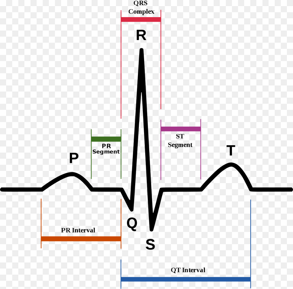 P Qrs T Ecg, Diagram Png