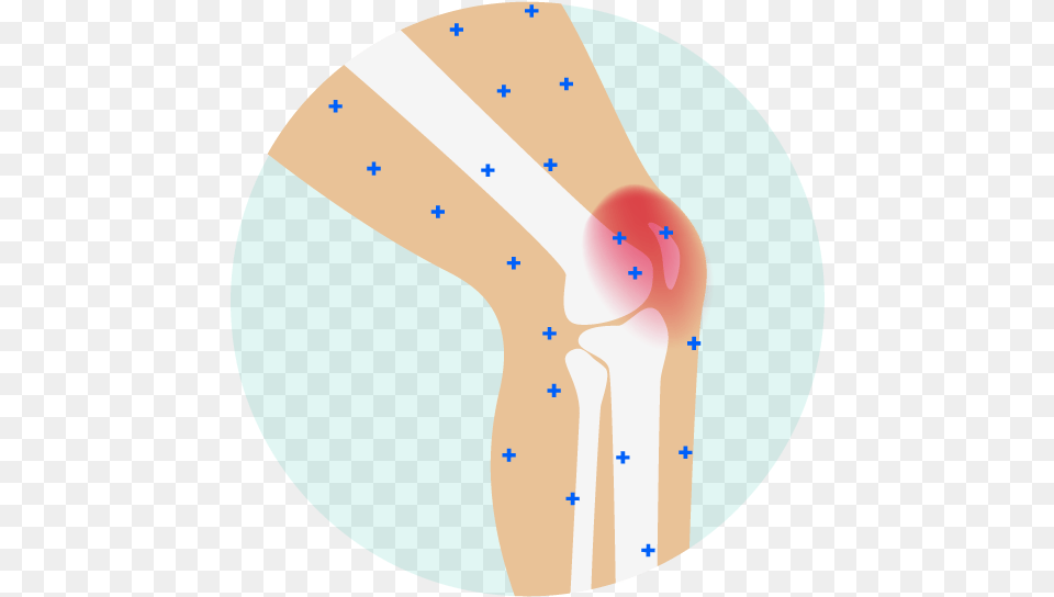 Pain Clipart Stiffness Knee Pain Cartoon, Cutlery, Disk Free Transparent Png