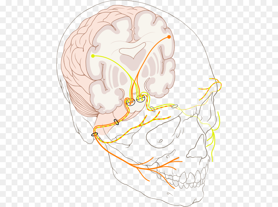 Palsy Nerve Diagram, Baby, Person Free Transparent Png