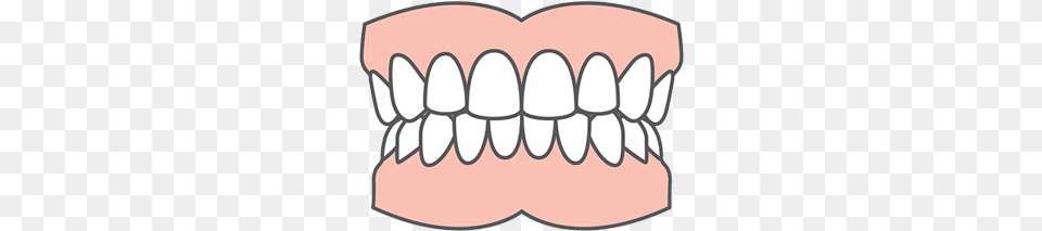 Partial Dentures Dental Implant Icon, Body Part, Mouth, Person, Teeth Free Png