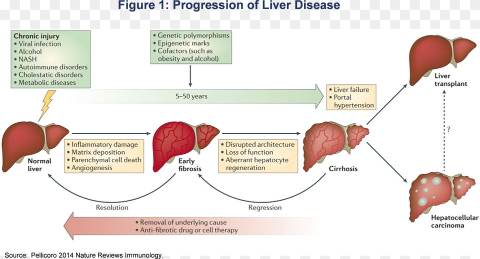 Pathophysiology Of Chronic Liver Cell Disease Free Transparent Png