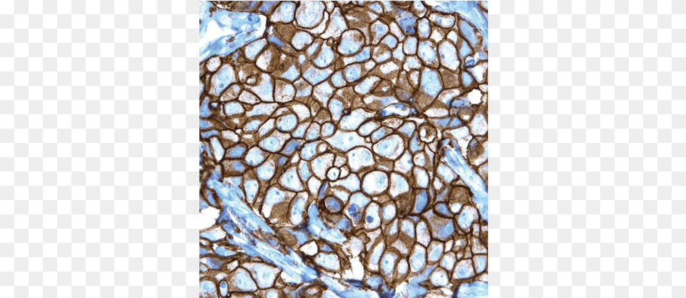 Pathway Her 2neu Rabbit Monoclonal Primary Antibody Stained Glass, Rock Free Transparent Png