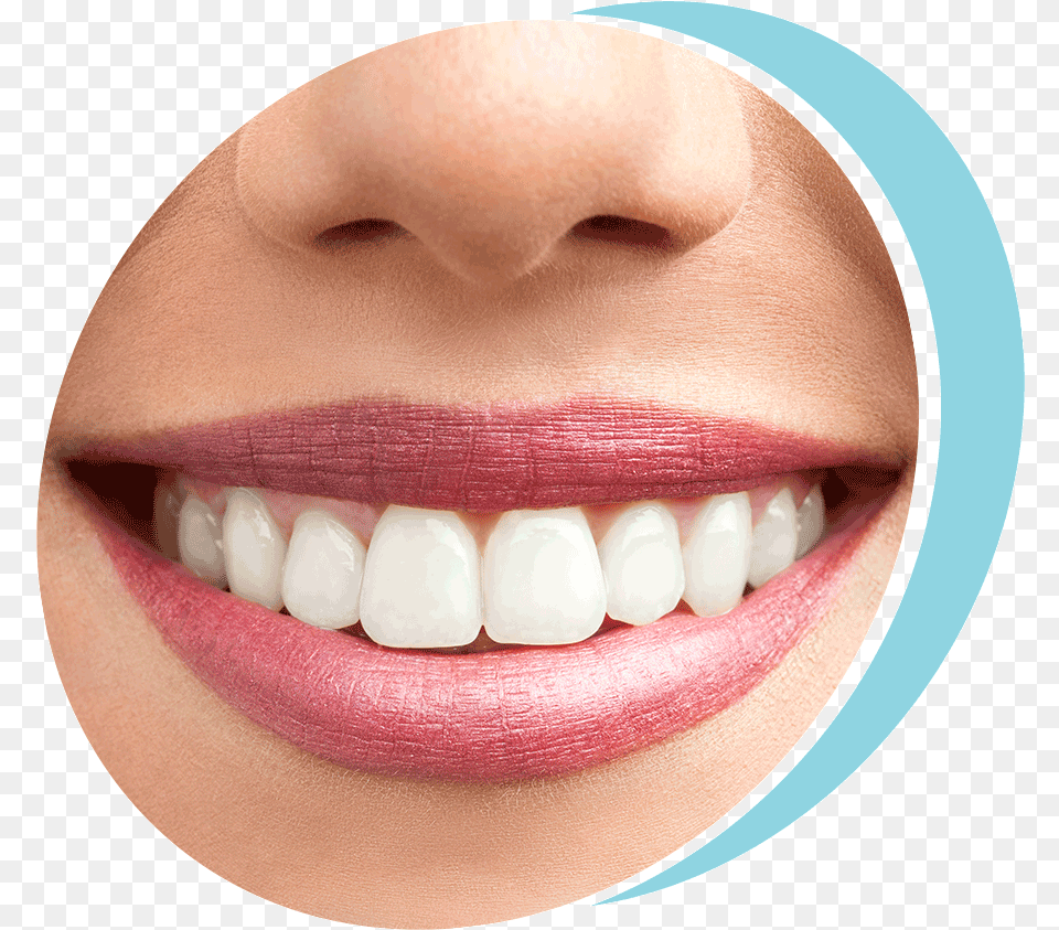 Patient Smiling After Laser Soft Tissue Recontouring Before And After Smile, Body Part, Mouth, Person, Teeth Free Transparent Png