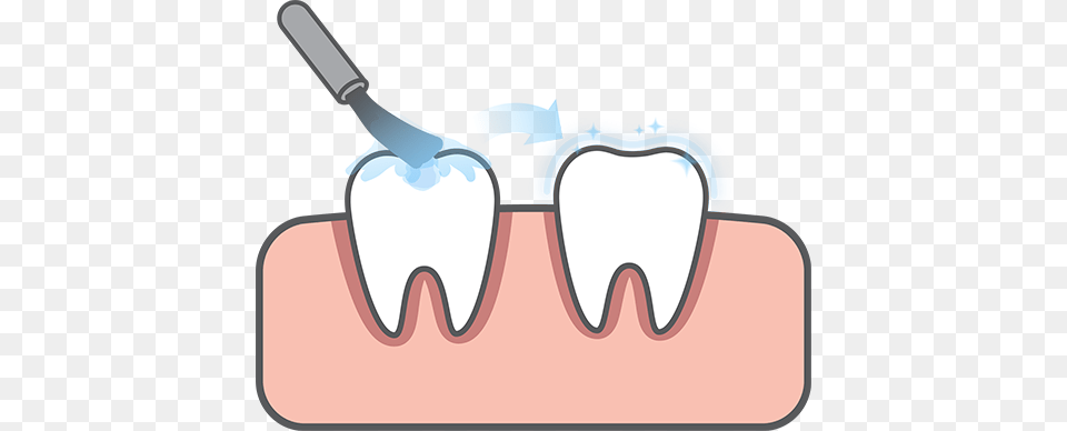 Pediatric Dentistry In Broussard La, Body Part, Mouth, Person, Teeth Png