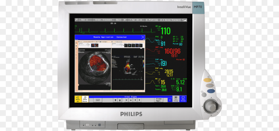 Philips Intellivue Mp70 Patient Monitor, Computer Hardware, Electronics, Hardware, Screen Free Transparent Png