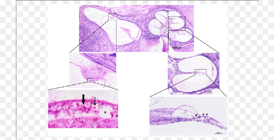 Photomicrograph Of The Left Temporal Bone Thin Arrow U003d Type Sketch, Purple, Paper, Art, Towel Free Transparent Png