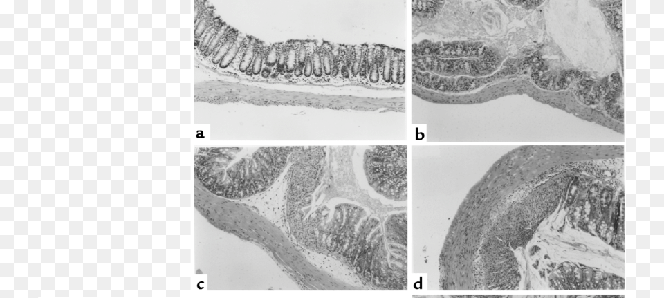 Photomicrographs Of The Proximal Colon Of Mice Treated Monochrome, Ct Scan Free Png