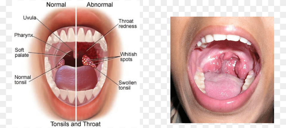 Picture, Throat, Person, Body Part, Mouth Free Png Download