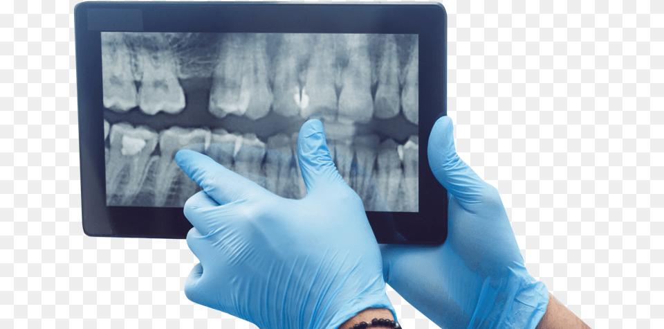 Picture Dentistry, Glove, Clothing, Woman, Person Png