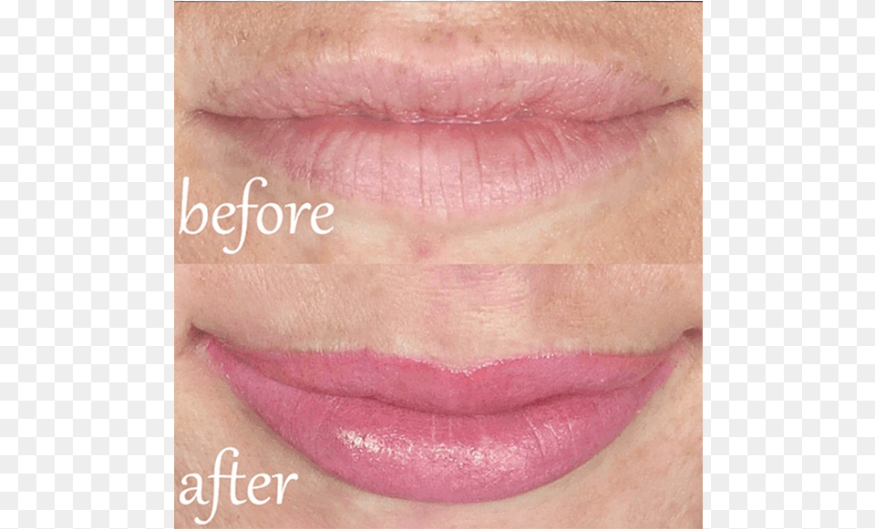 Pigment Is Applied Directly Onto The Lips Providing Lip Gloss, Body Part, Mouth, Person, Teeth Png Image