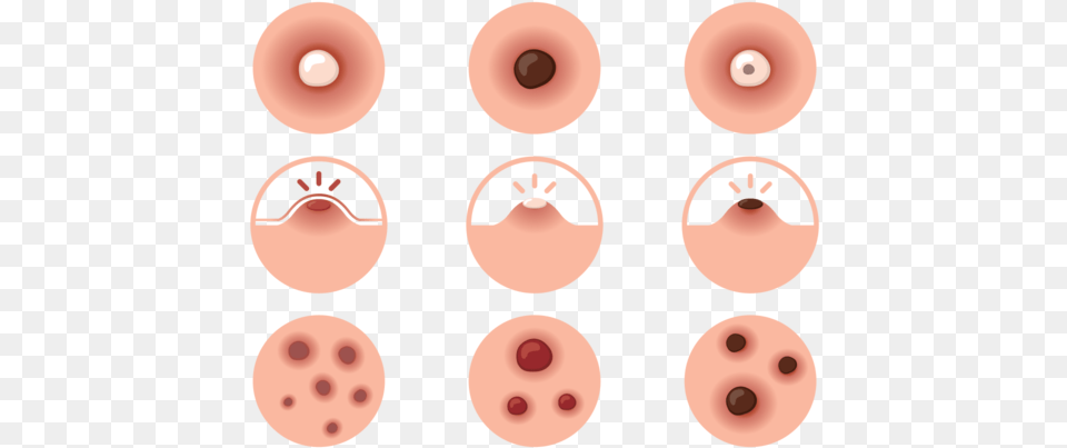 Pimple 4 Image Pimple, Snout, Disk, Food, Sweets Free Png