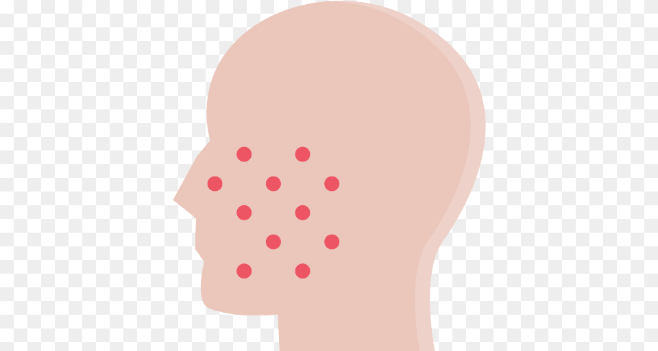 Pimples Skin Icon Illustration, Body Part, Face, Head, Neck Free Transparent Png