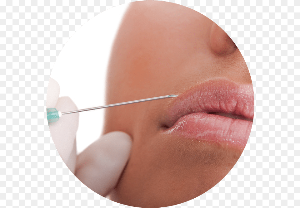 Pink Lips Injection Download Injection, Body Part, Mouth, Person, Baby Free Png