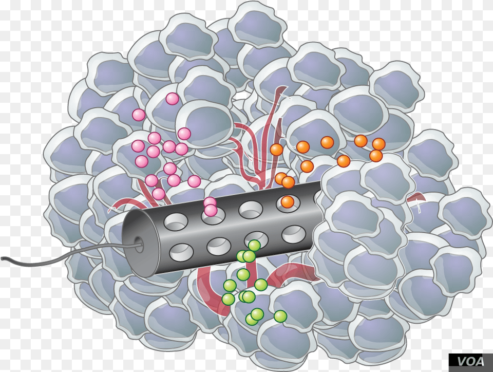 Placed In The Tumor The Device Releases Microdoses Implantable Therapeutic Cancer, Pattern, Dynamite, Weapon Png Image