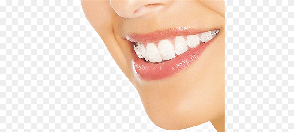Planes Ortodoncia Desde 180 Tongue, Body Part, Mouth, Person, Teeth Png