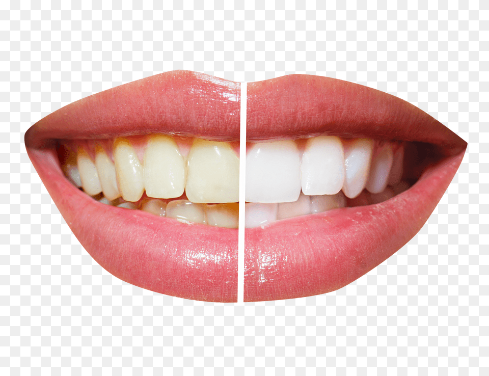 Pngpix Com Teeth Whitening Image, Body Part, Mouth, Person, Animal Free Transparent Png