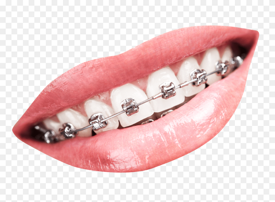 Pngpix Com Teeth With Braces Body Part, Person, Mouth, Weapon Png Image