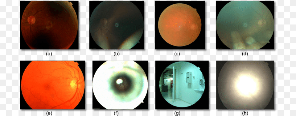 Poor Quality Of Fundus, Lighting, Sphere, Astronomy, Outer Space Png