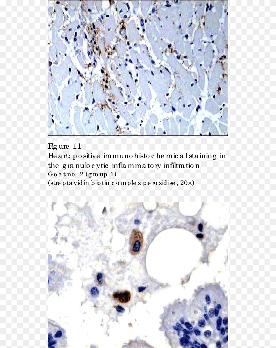 Positive Immunohistochemical Staining Of The Granulocytes Immunohistochemistry, Paper, Chandelier, Lamp, Stain Png Image