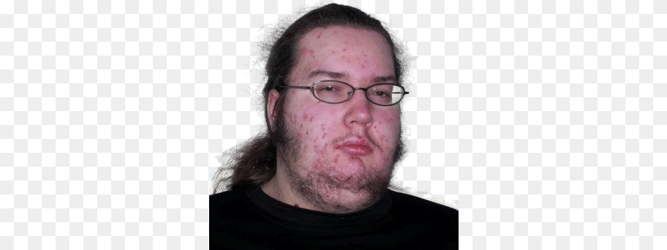 Post Fat Gamer Nerd, Male, Adult, Person, Face Png Image