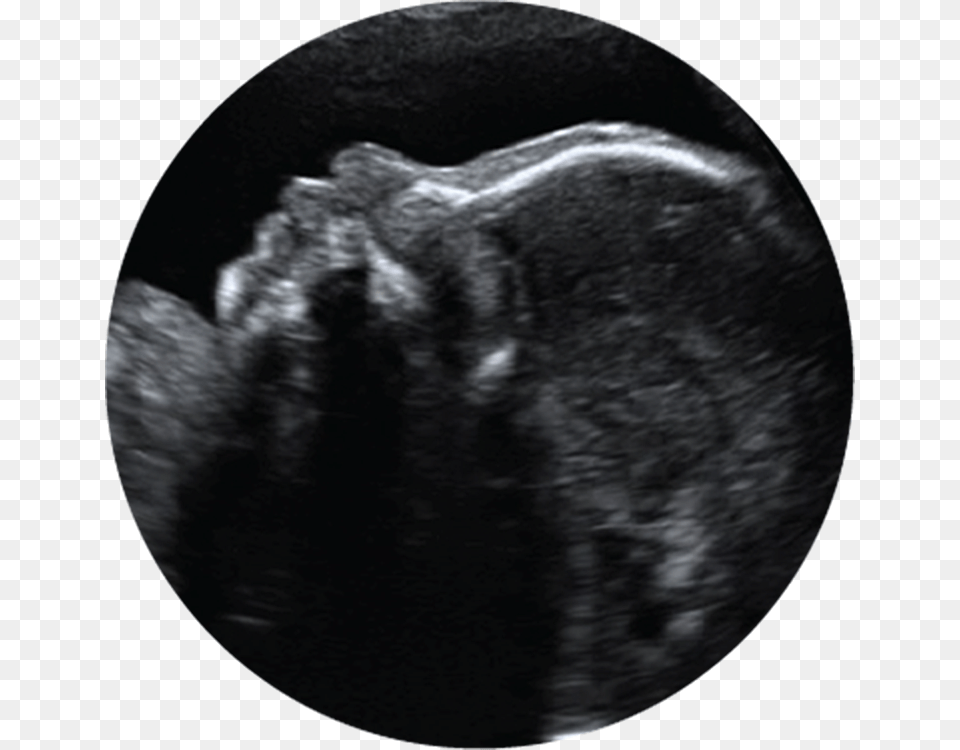 Prenatal Ultrasound Clipart, Ct Scan, Person Free Png