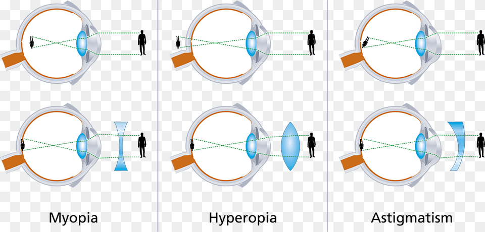 Presbiopia Nei Bambini Quando Preoccuparsi, Sphere, Person Png Image