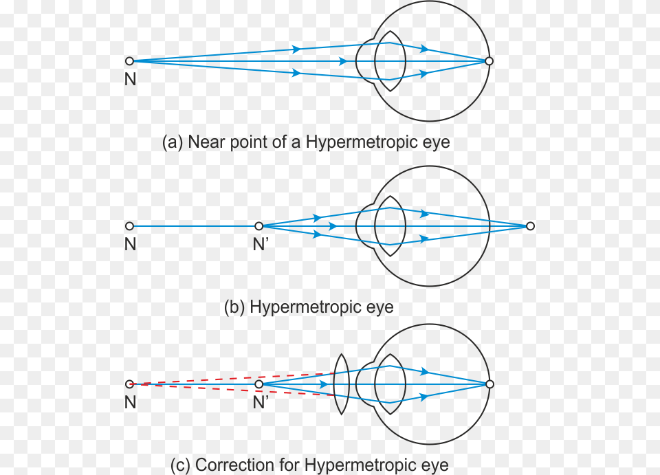 Presbyopia Diagram, Astronomy, Moon, Nature, Night Png Image