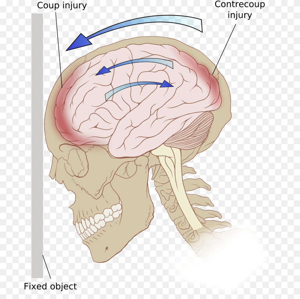 Prevalence Traumatic Brain Injury, Body Part, Face, Head, Neck Png Image