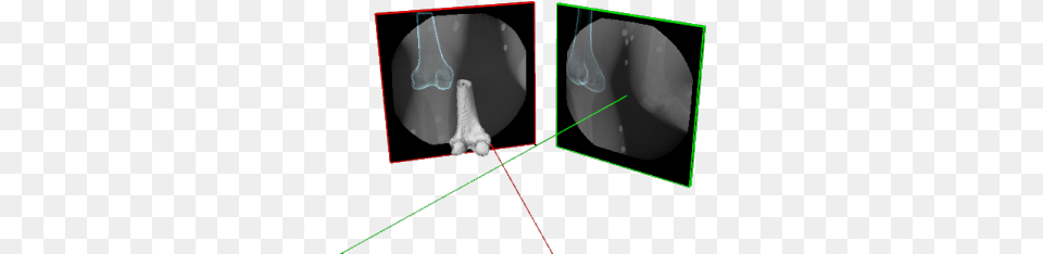 Processing Requires A Hi Res Ct Scan Of The Subject Radiology, Ct Scan, Person, X-ray, Adult Free Png Download