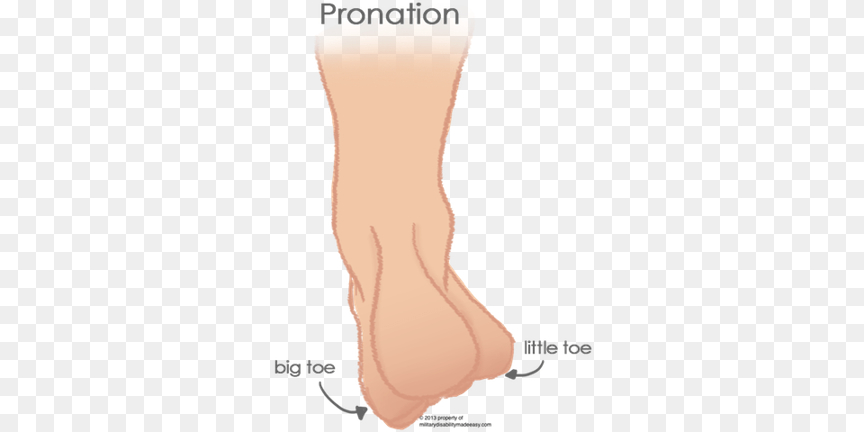 Pronation Of The Foot 3 Flat Feet Calluses, Ankle, Body Part, Hand, Person Free Png