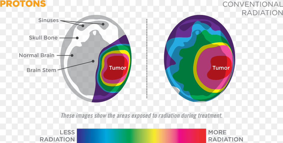 Proton Beam Therapy Diagram, Nature, Night, Outdoors, Sphere Png