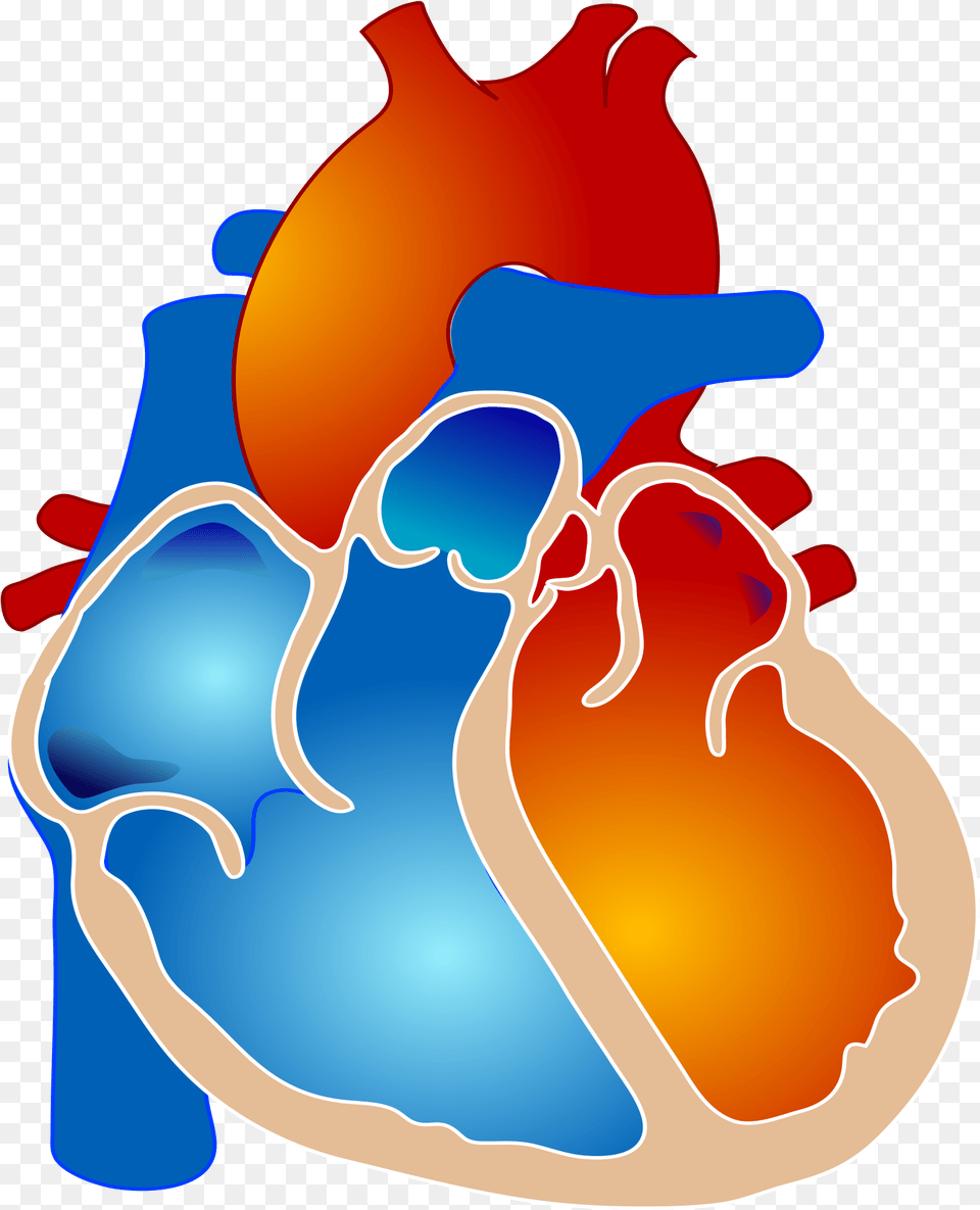 Pulmonary Atresia With Single Ventricle Clipart Tetralogy Of Fallot, Smoke Pipe Free Png