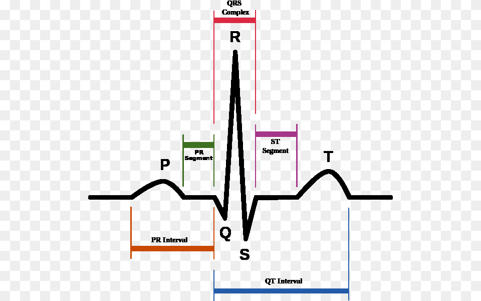 Qrs Complex Qrs Ecg, Chart, Plot Png Image