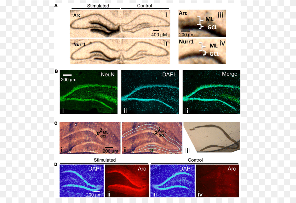 Radioactive In Situ Hybridization Of The Immediate Immediate Early Gene, Art, Collage, Car, Transportation Png