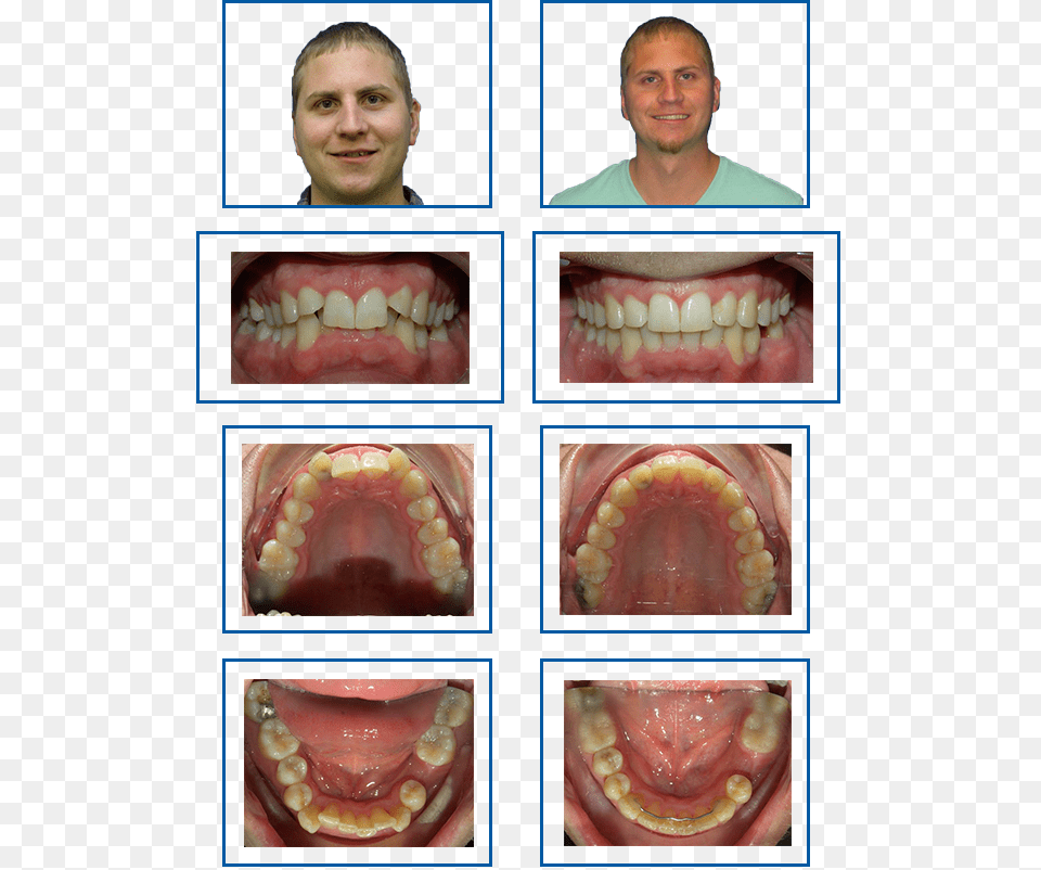Randall Medical, Teeth, Person, Mouth, Body Part Free Png Download