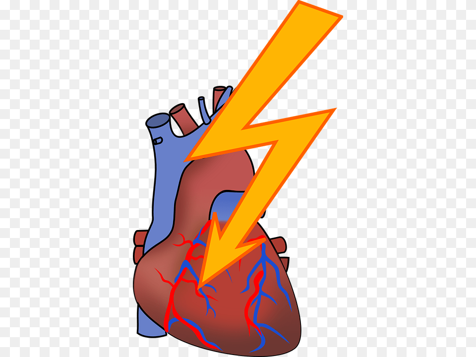 Rate Clipart Heart Failure, Clothing, Footwear, High Heel, Shoe Free Transparent Png