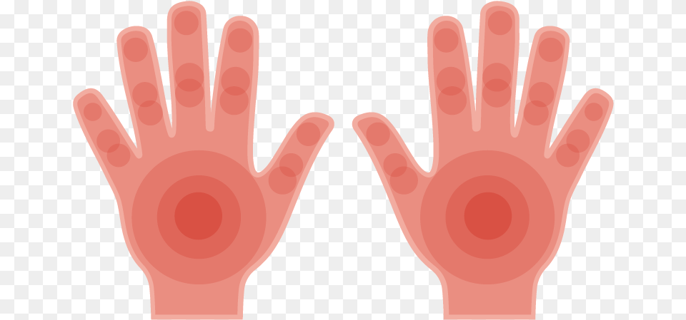Red Palms Symptoms Causes U0026 Common Questions Buoy Sign Language, Body Part, Person, Hand, Finger Free Png