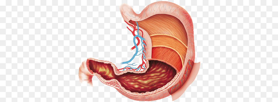Reduce Stomach Problems Humans Cant Digest Cellulose, Body Part, Ct Scan Free Png Download