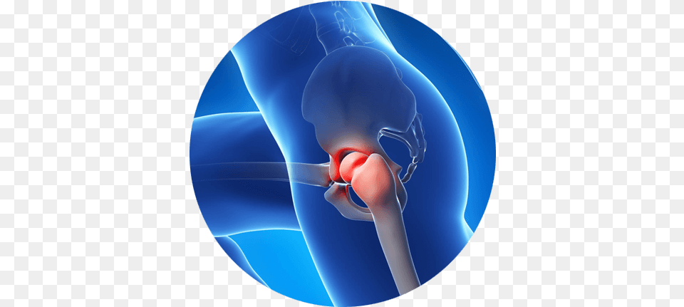 Relieve Hip Pain Without Surgery Hip Pain, Baby, Person, Sphere, Ct Scan Free Transparent Png