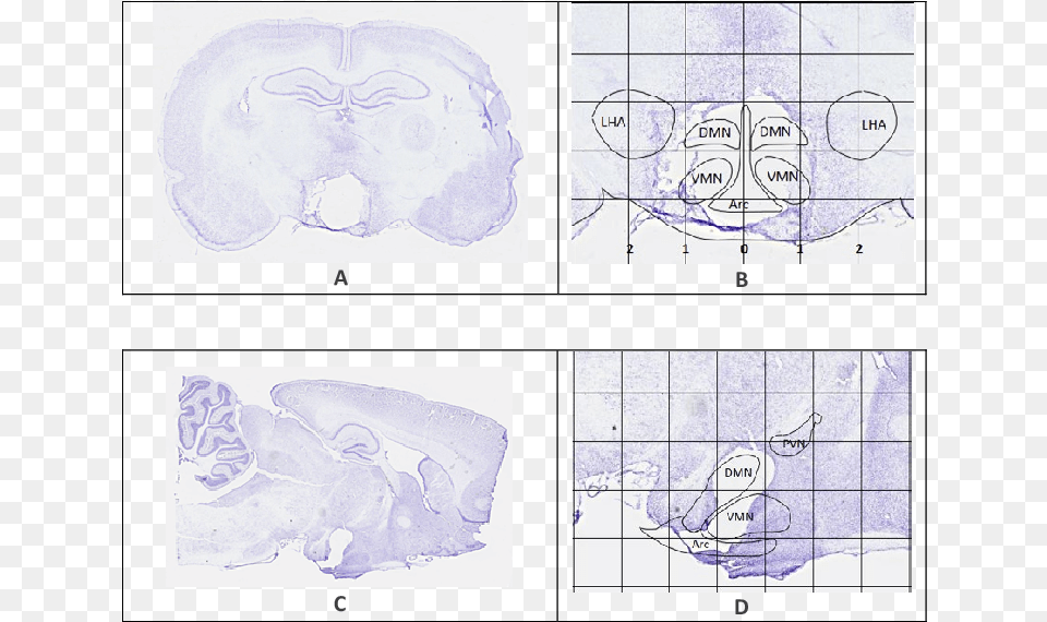 Representative Brain Sections Showing The Extent Of Brain, Ct Scan, Art, Ice, Text Free Png