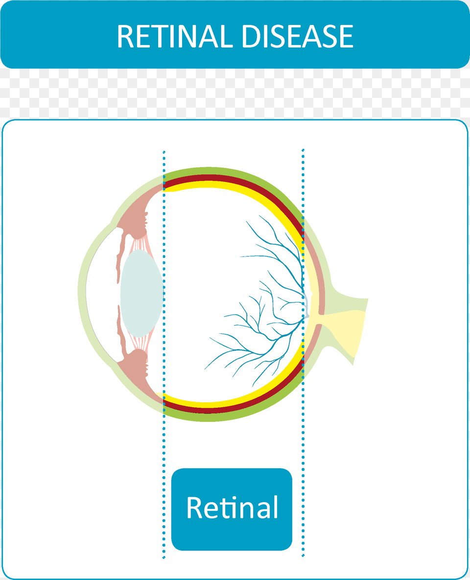 Retinal Diseases Circle, Page, Text Free Png