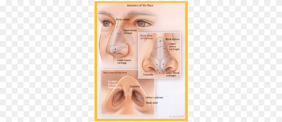 Rhinoplasty Commonly Known As A Nose Job Is The Nose Anatomy Rhinoplasty, Body Part, Face, Head, Neck Free Transparent Png