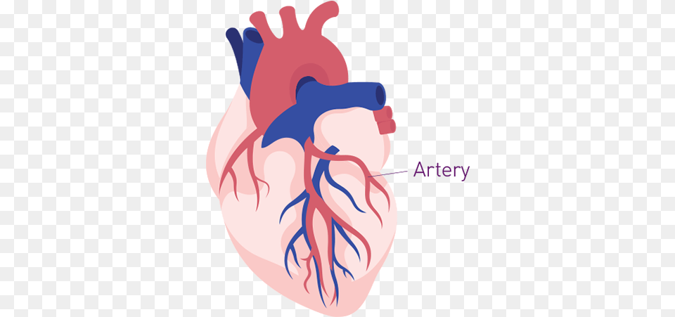 Risk Of Second Heart Attack Brilinta Ticagrelor Tablets Illustration, Baby, Person Free Transparent Png