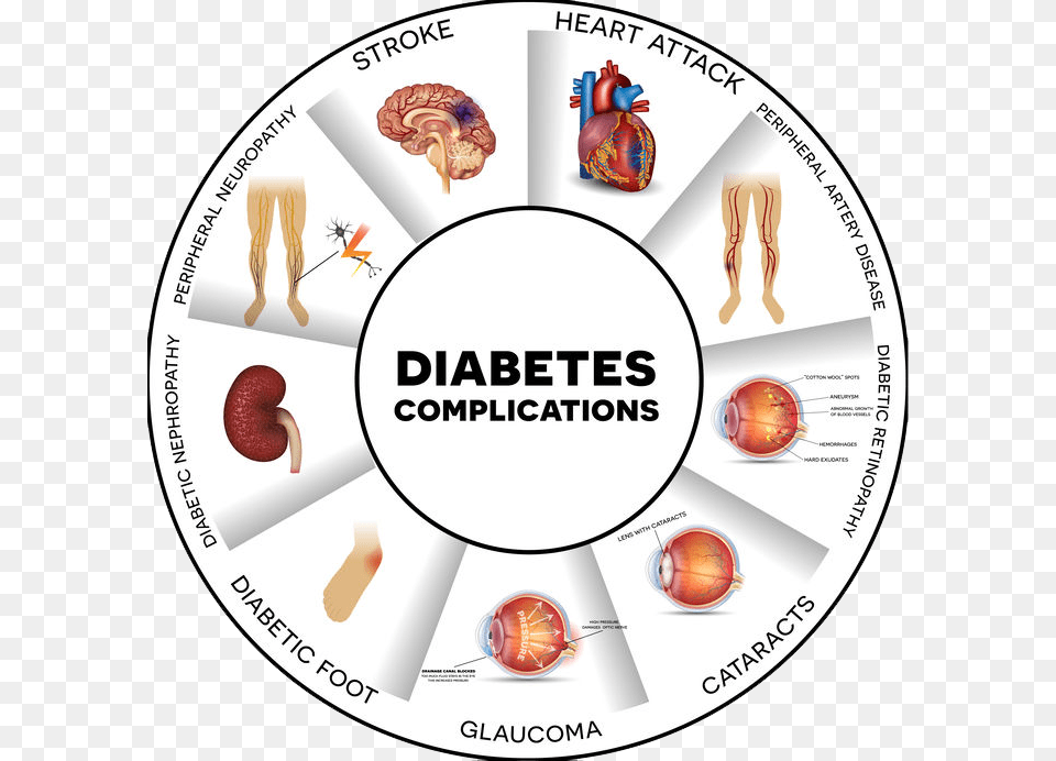 S Complications Of Diabetes Poster, Person Free Png