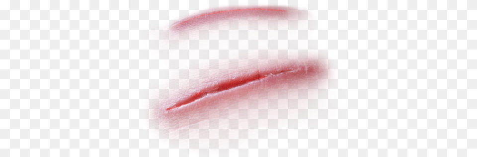 Scar, Body Part, Mouth, Person, Flower Free Transparent Png