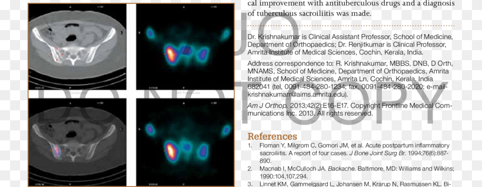 Screenshot, Ct Scan Free Transparent Png