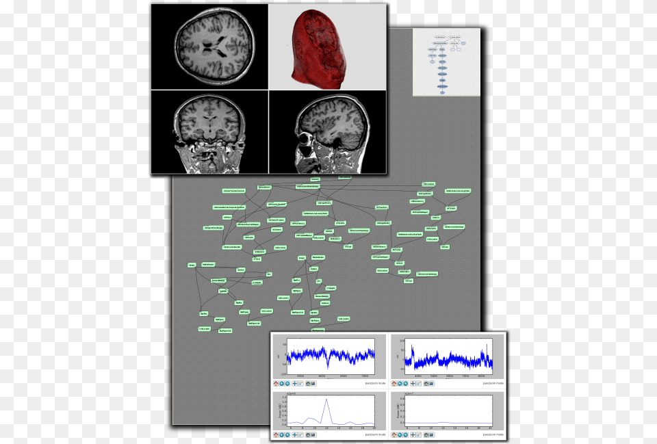 Screenshot, Ct Scan, Computer Hardware, Electronics, Hardware Free Png Download