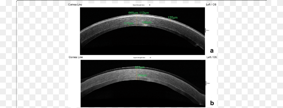 Screenshot, Art, Collage, Ct Scan, Machine Png Image