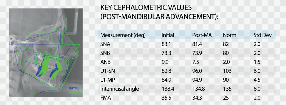 Screenshot, Chart, Plot, Ct Scan, Text Png